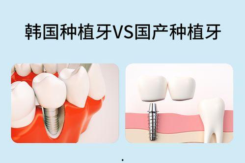 国产种植牙价格表,性价比之选，为您揭秘种植牙新趋势